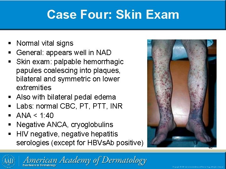 Case Four: Skin Exam § Normal vital signs § General: appears well in NAD