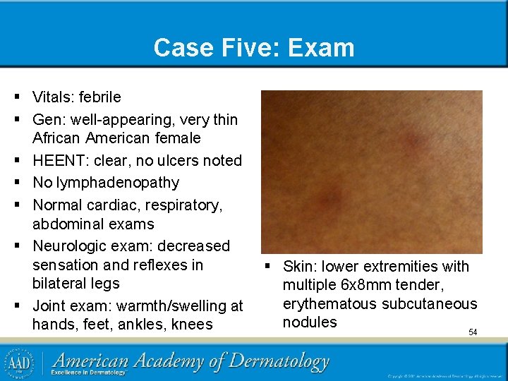 Case Five: Exam § Vitals: febrile § Gen: well-appearing, very thin African American female