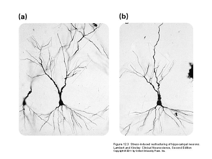 Figure 12. 3 Stress-induced restructuring of hippocampal neurons. Lambert and Kinsley: Clinical Neuroscience, Second