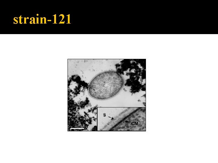 strain-121 