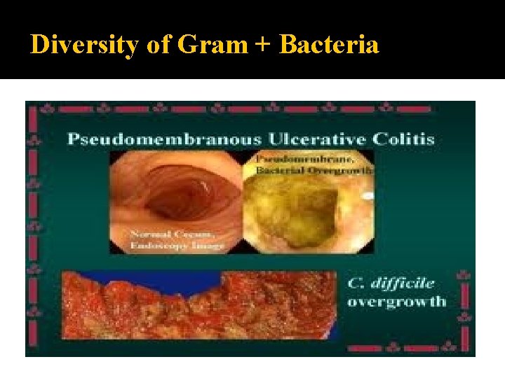 Diversity of Gram + Bacteria 