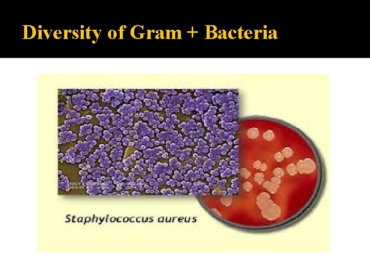 Diversity of Gram + Bacteria 