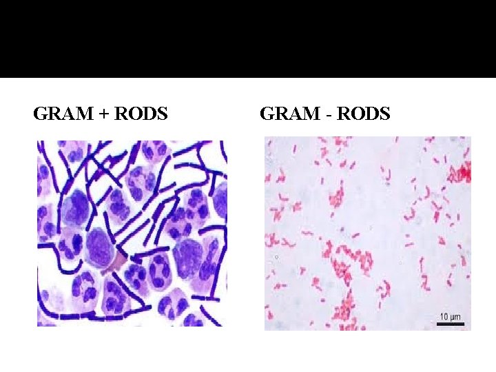 GRAM + RODS GRAM - RODS 