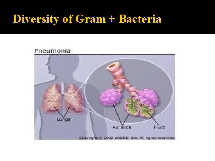 Diversity of Gram + Bacteria 