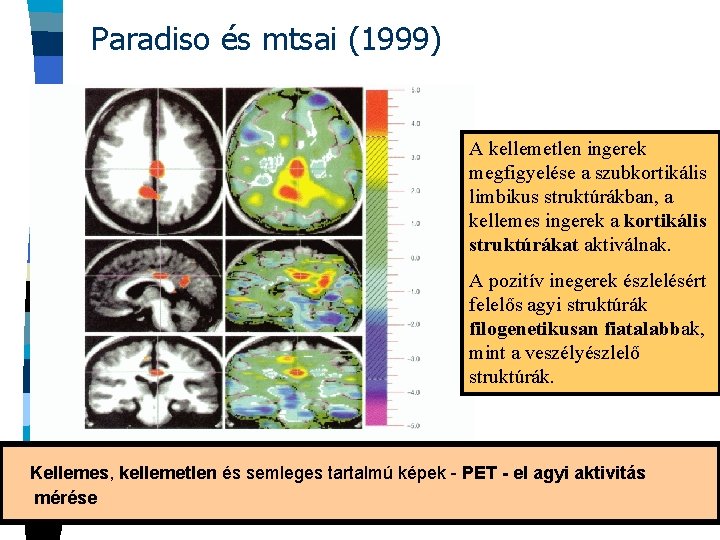 Paradiso és mtsai (1999) A kellemetlen ingerek megfigyelése a szubkortikális limbikus struktúrákban, a kellemes