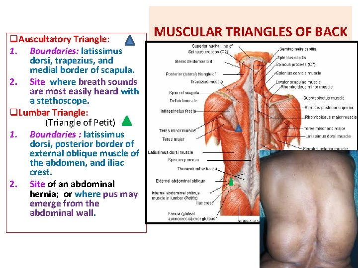 q. Auscultatory Triangle: 1. Boundaries: latissimus dorsi, trapezius, and medial border of scapula. 2.