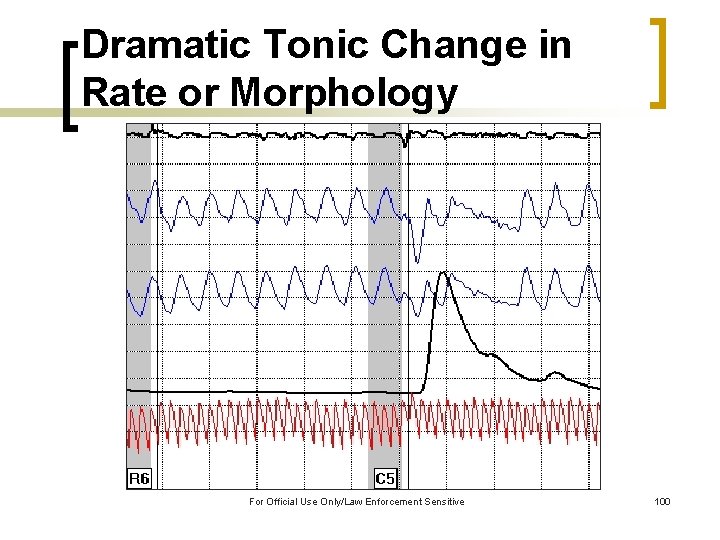 Dramatic Tonic Change in Rate or Morphology For Official Use Only/Law Enforcement Sensitive 100