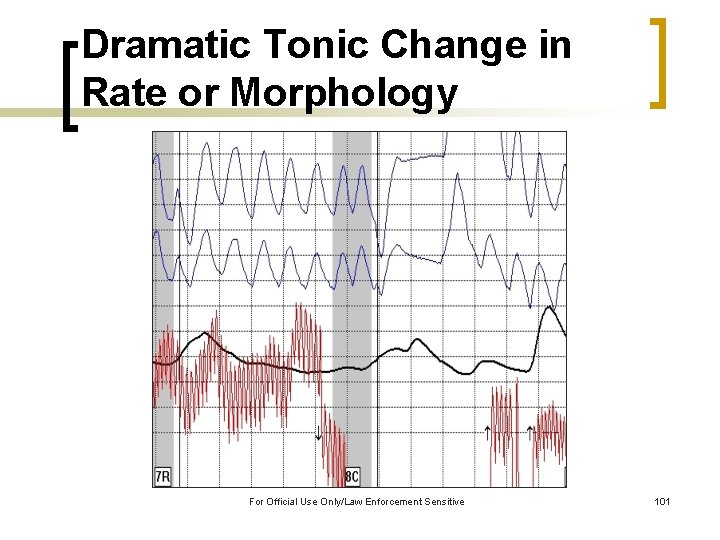 Dramatic Tonic Change in Rate or Morphology For Official Use Only/Law Enforcement Sensitive 101