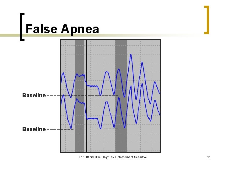False Apnea Baseline For Official Use Only/Law Enforcement Sensitive 11 