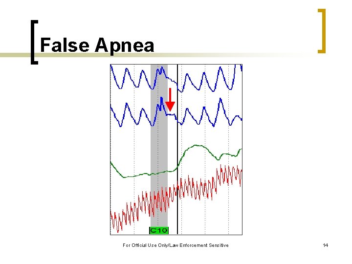 False Apnea For Official Use Only/Law Enforcement Sensitive 14 