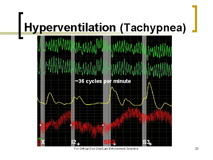 Hyperventilation (Tachypnea) ~36 cycles per minute For Official Use Only/Law Enforcement Sensitive 23 