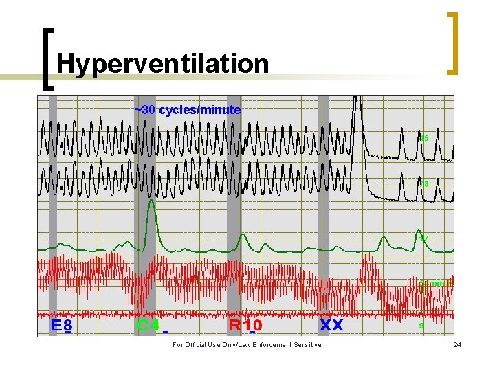 Hyperventilation ~30 cycles/minute For Official Use Only/Law Enforcement Sensitive 24 