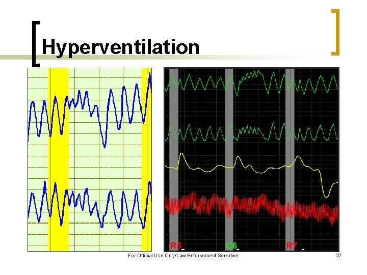 Hyperventilation For Official Use Only/Law Enforcement Sensitive 27 