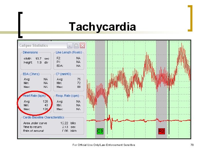Tachycardia For Official Use Only/Law Enforcement Sensitive 78 