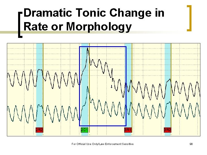 Dramatic Tonic Change in Rate or Morphology For Official Use Only/Law Enforcement Sensitive 98