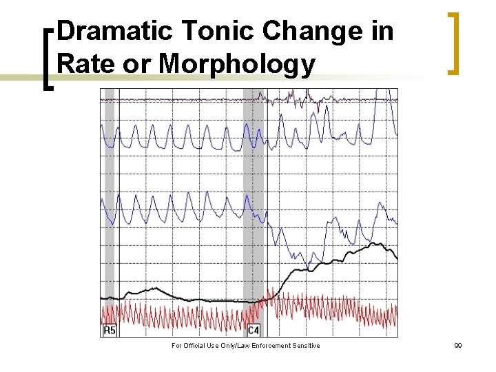 Dramatic Tonic Change in Rate or Morphology For Official Use Only/Law Enforcement Sensitive 99