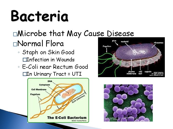 Bacteria �Microbe that May Cause Disease �Normal Flora ◦ Staph on Skin Good �Infection