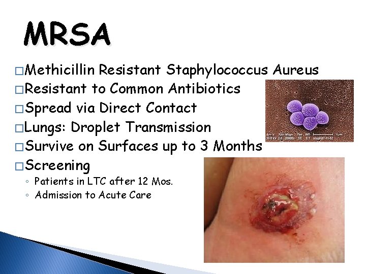 MRSA � Methicillin Resistant Staphylococcus Aureus � Resistant to Common Antibiotics � Spread via