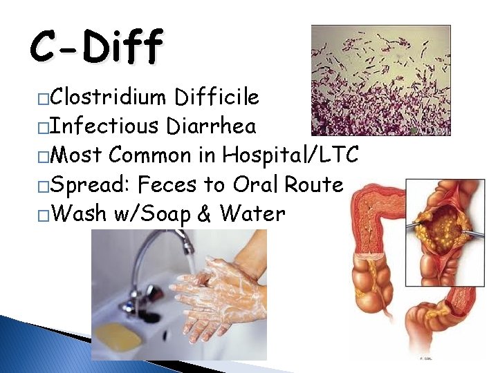 C-Diff �Clostridium Difficile �Infectious Diarrhea �Most Common in Hospital/LTC �Spread: Feces to Oral Route