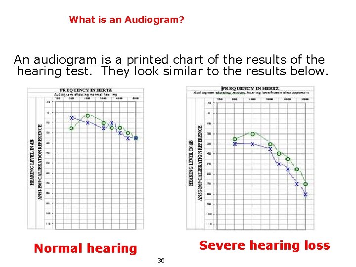 What is an Audiogram? An audiogram is a printed chart of the results of