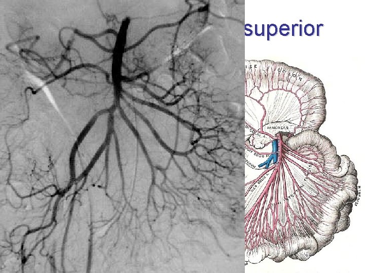 Arteria mesenterica superior • L 1, 1 cm below TC ventrally: collum pancreatis dorsally: