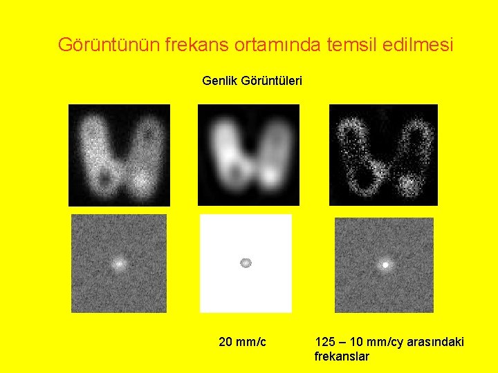 Görüntünün frekans ortamında temsil edilmesi Genlik Görüntüleri 20 mm/c 125 – 10 mm/cy arasındaki