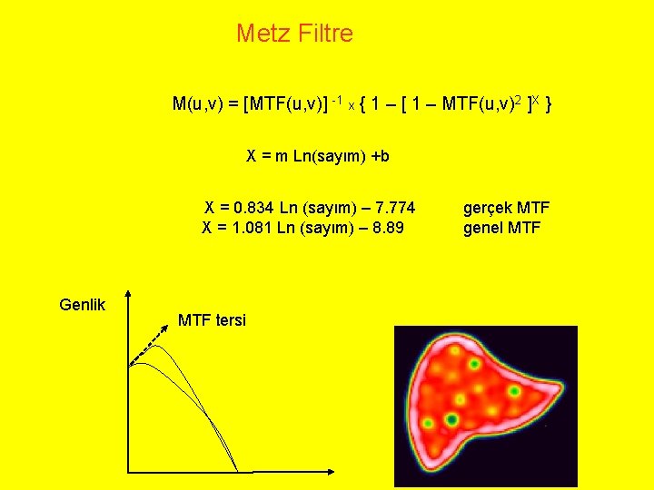 Metz Filtre M(u, v) = [MTF(u, v)] -1 x { 1 – [ 1