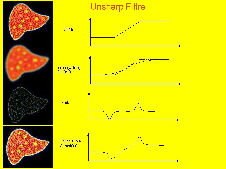 Unsharp Filtre Orjinal Yumuşatılmış Görüntü Fark Orijinal+Fark Görüntüsü 