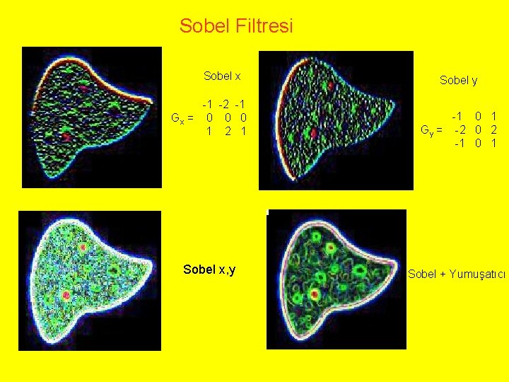 Sobel Filtresi Sobel x -1 -2 -1 Gx = 0 0 0 1 2