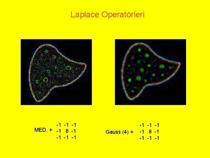 Laplace Operatörleri -1 -1 -1 MED. + -1 8 -1 -1 Gauss (4) +