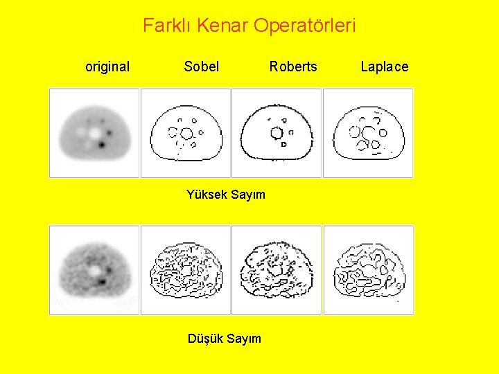 Farklı Kenar Operatörleri original Sobel Yüksek Sayım Düşük Sayım Roberts Laplace 