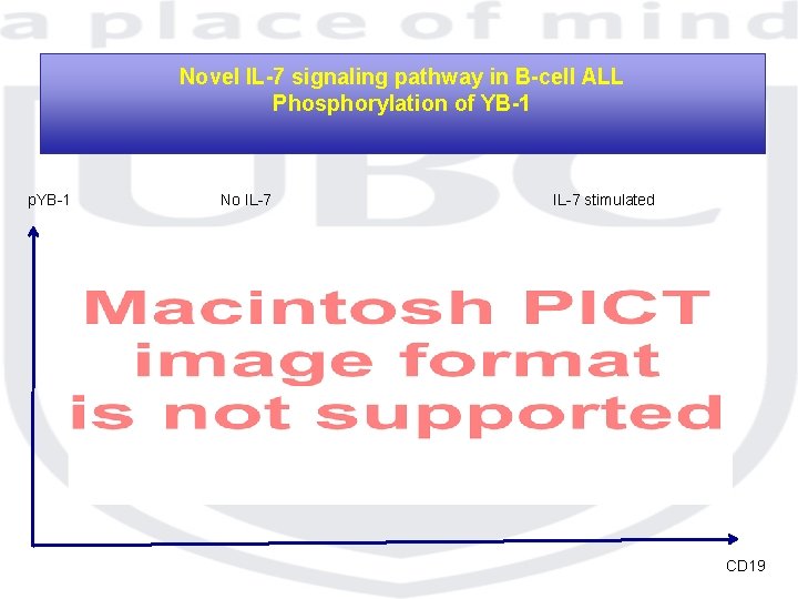 Novel IL-7 signaling pathway in B-cell ALL Phosphorylation of YB-1 p. YB-1 No IL-7