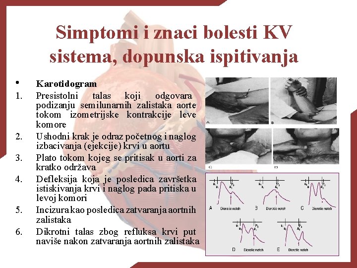 Simptomi i znaci bolesti KV sistema, dopunska ispitivanja • 1. 2. 3. 4. 5.