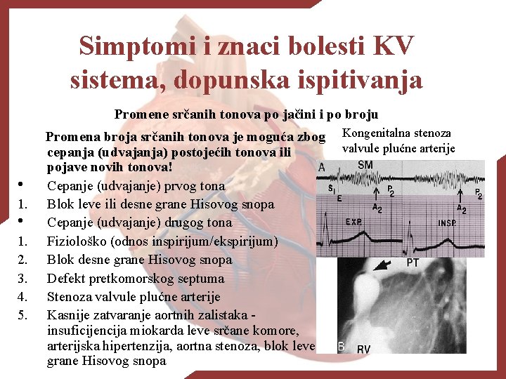 Simptomi i znaci bolesti KV sistema, dopunska ispitivanja Promene srčanih tonova po jačini i