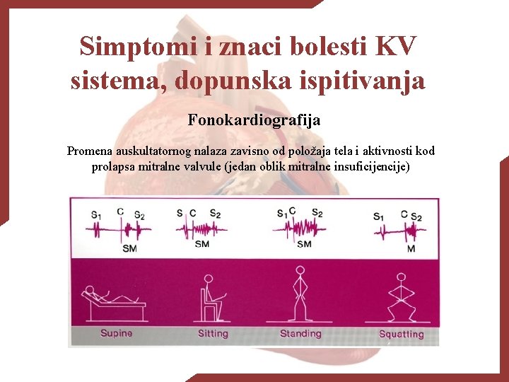 Simptomi i znaci bolesti KV sistema, dopunska ispitivanja Fonokardiografija Promena auskultatornog nalaza zavisno od