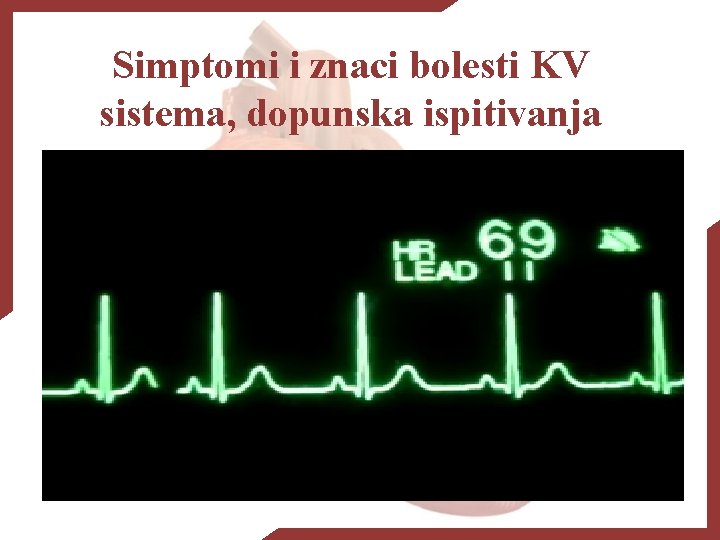 Simptomi i znaci bolesti KV sistema, dopunska ispitivanja 