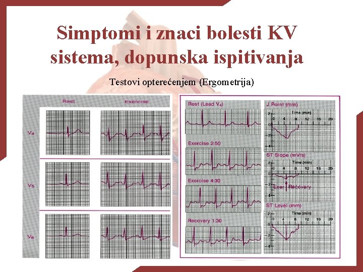 Simptomi i znaci bolesti KV sistema, dopunska ispitivanja Testovi opterećenjem (Ergometrija) 
