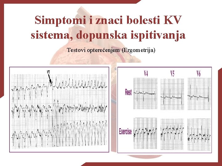 Simptomi i znaci bolesti KV sistema, dopunska ispitivanja Testovi opterećenjem (Ergometrija) 