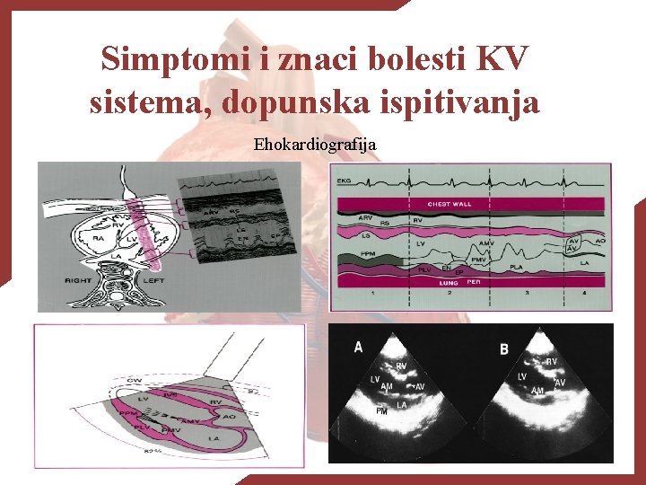 Simptomi i znaci bolesti KV sistema, dopunska ispitivanja Ehokardiografija 