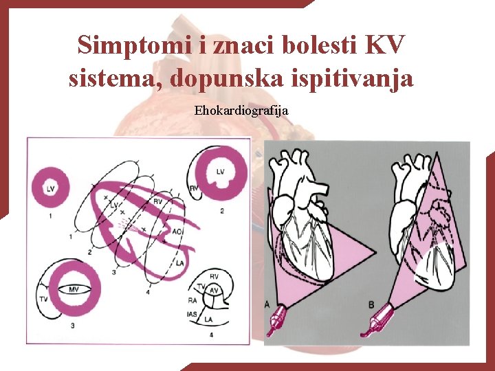 Simptomi i znaci bolesti KV sistema, dopunska ispitivanja Ehokardiografija 