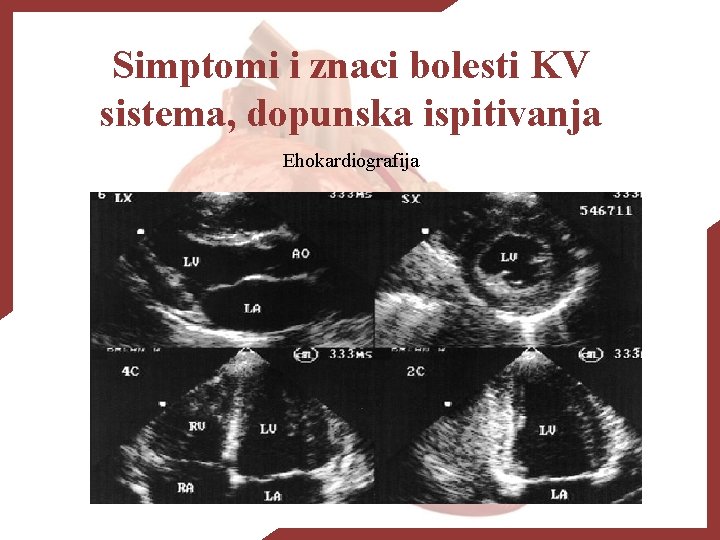 Simptomi i znaci bolesti KV sistema, dopunska ispitivanja Ehokardiografija 