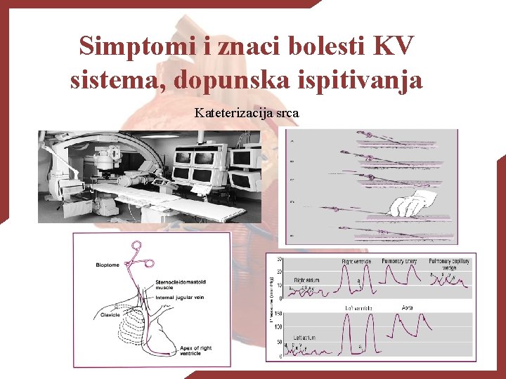 Simptomi i znaci bolesti KV sistema, dopunska ispitivanja Kateterizacija srca 