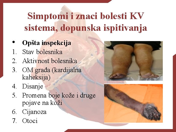 Simptomi i znaci bolesti KV sistema, dopunska ispitivanja • 1. 2. 3. 4. 5.