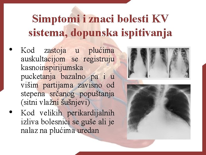 Simptomi i znaci bolesti KV sistema, dopunska ispitivanja • • Kod zastoja u plućima
