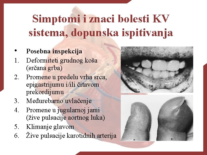 Simptomi i znaci bolesti KV sistema, dopunska ispitivanja • 1. 2. 3. 4. 5.