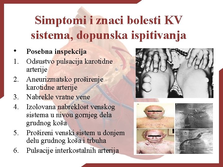 Simptomi i znaci bolesti KV sistema, dopunska ispitivanja • 1. 2. 3. 4. 5.