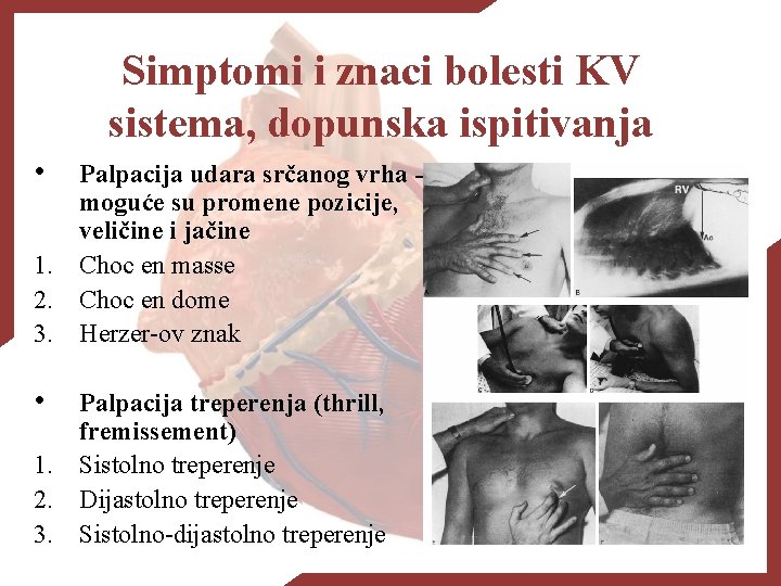 Simptomi i znaci bolesti KV sistema, dopunska ispitivanja • Palpacija udara srčanog vrha moguće