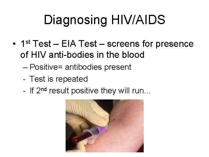 Diagnosing HIV/AIDS • 1 st Test – EIA Test – screens for presence of