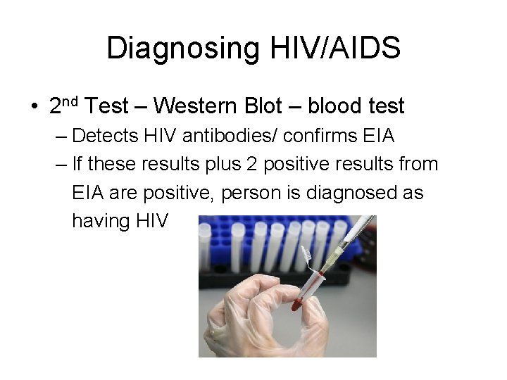 Diagnosing HIV/AIDS • 2 nd Test – Western Blot – blood test – Detects