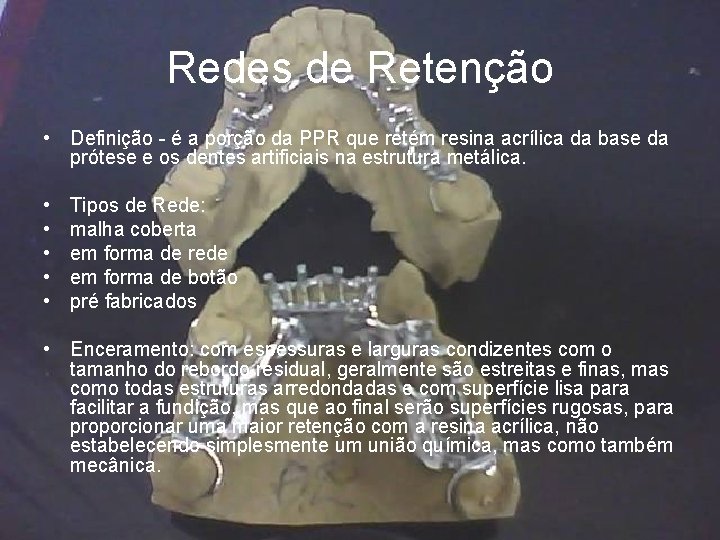 Redes de Retenção • Definição - é a porção da PPR que retém resina